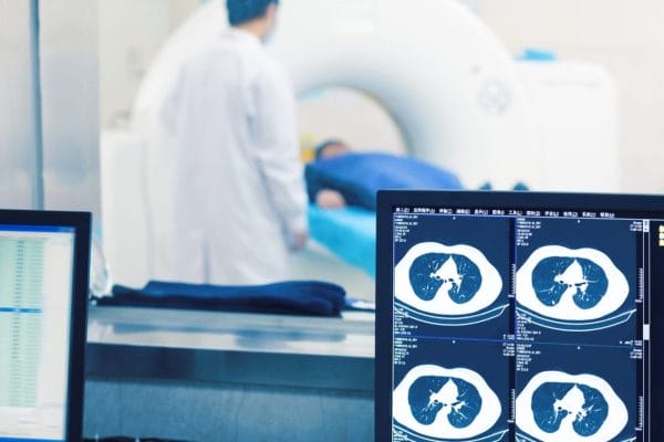healthpartners wide A medical professional stands next to a patient lying on a CT scanner bed, while computer monitors in the foreground display lung scan images and medical data.